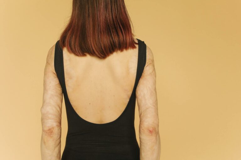 Back view of a woman in a black swimsuit with visible scars against a yellow background.